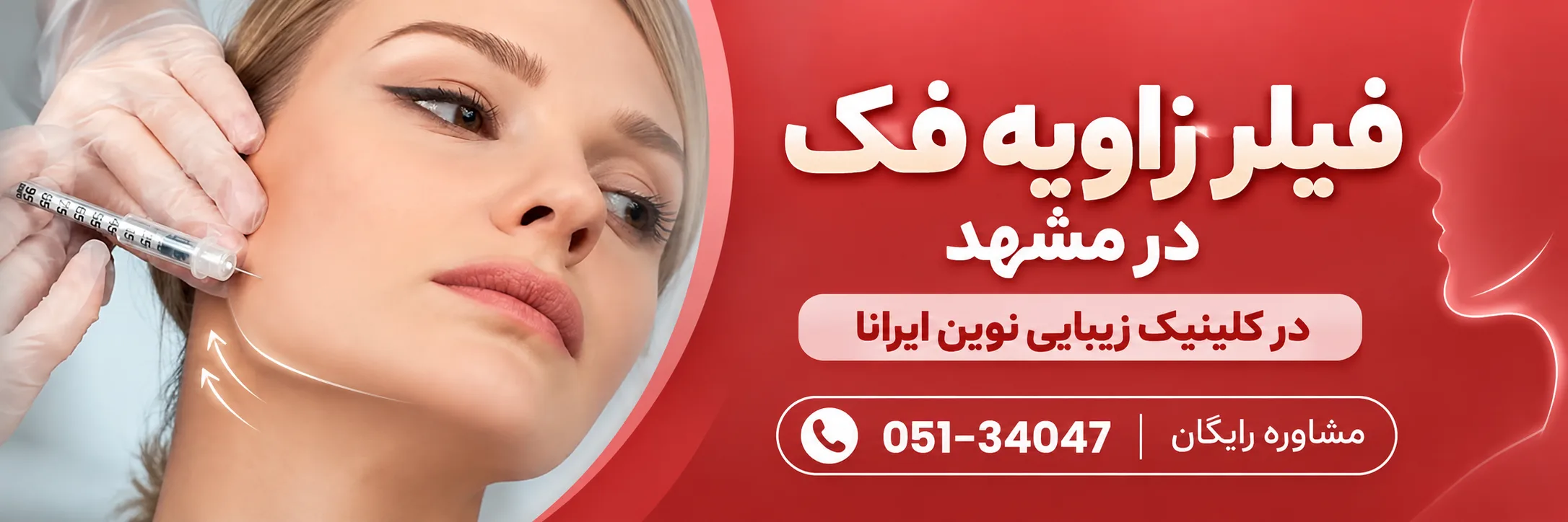 فیلر زاویه فک در کلینیک نوین ایرانا